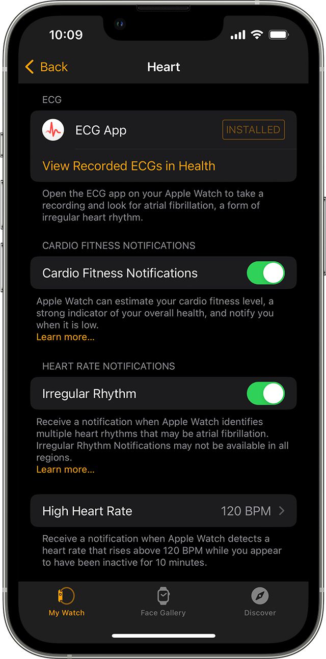 YY易游体育：从健康监测到生命守护：AppleWatch科技创新与人文关怀交织的十年(图5)