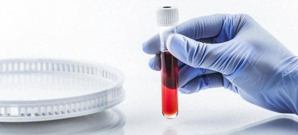 月饼立大功？医生发现：高血糖患者吃月饼时多注意这几点(图2)